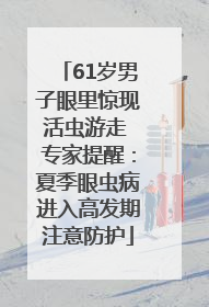 61岁男子眼里惊现活虫游走 专家提醒：夏季眼虫病进入高发期注意防护